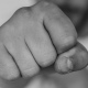 В Курске продавец сломал челюсть покупателю за возмущение ценой на груши
